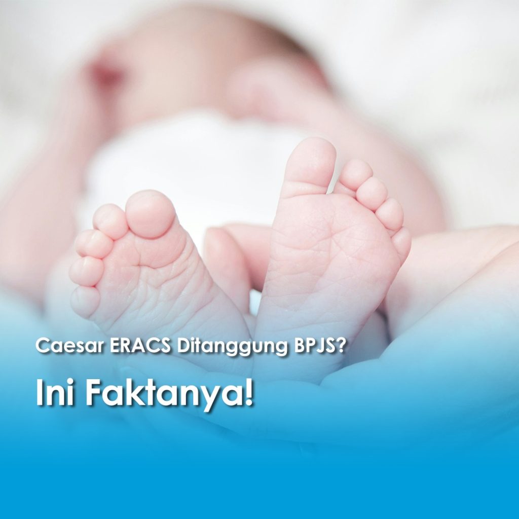 Caesar ERACS Ditanggung BPJS, Ini Faktanya! Ada foto bayi tertidur kelihatan kakinya