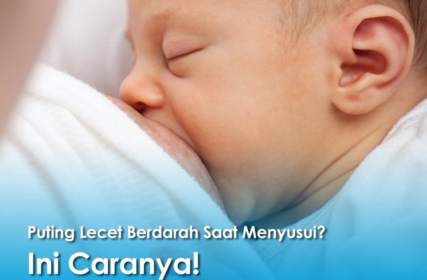 Bayi sedang menyusu di payudara ibu, ilustrasi puting lecet berdarah saat menyusui.